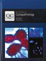 Quick Compendium of Cytopathology. Sara Monaco.